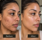 HERA 7-Color LED Light Therapy Face Mask