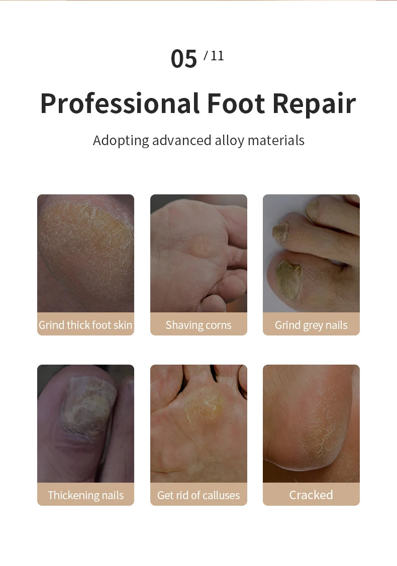 Portable Electric Foot Grinder USB Rechargeable Adjustable Speed Pedicure Tool Dead Skin Callus Remover for Foot Care
